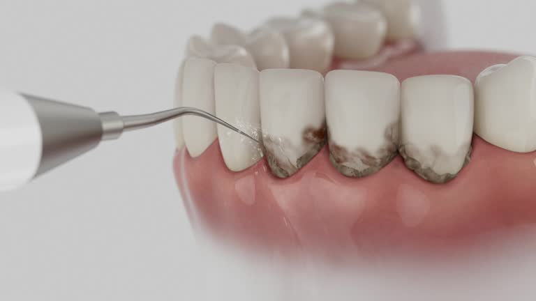 Trusted Emergency Dentist service in Moraga, CA - Dentist Open Now